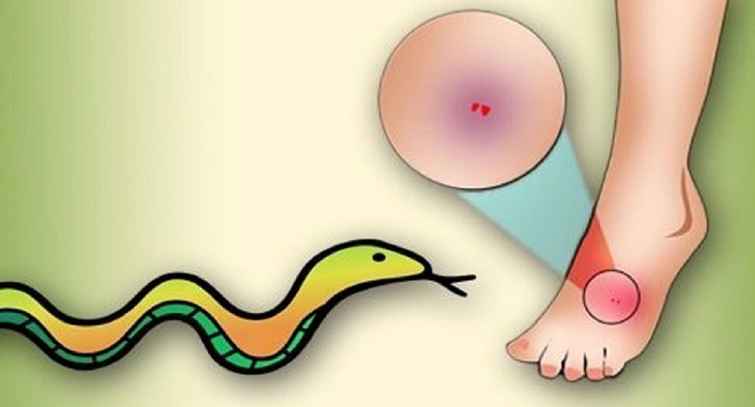 বোয়ালমারীতে সাপের কামড়ে গৃহবধূর মৃত্যু