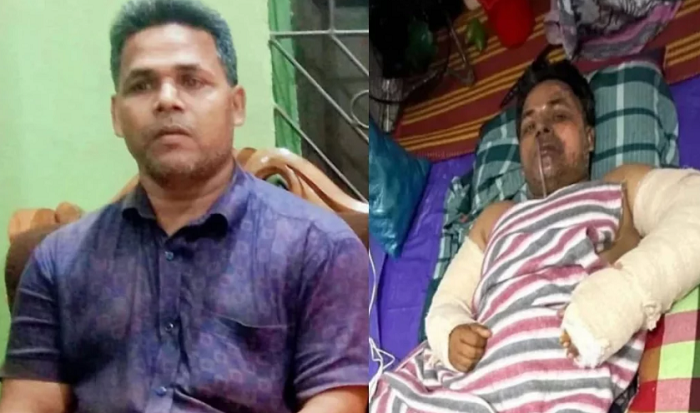 সোনাগাজীতে ইউটিউব দেখে অকটেন তৈরির চেষ্টা, বিস্ফোরণে মৃত্যু