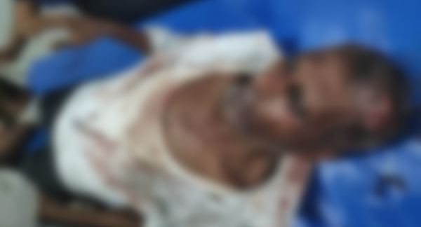 ওয়ারিশ সনদ আনতে গিয়ে রক্তাক্ত বৃদ্ধ, ইউএনওর কার্যালয়ে সালিশ