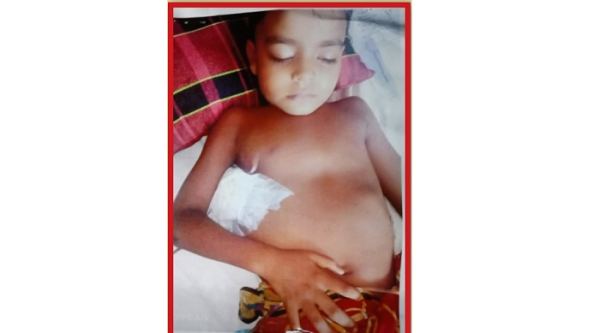 বাঁচতে চায় শিশু মোয়াজ