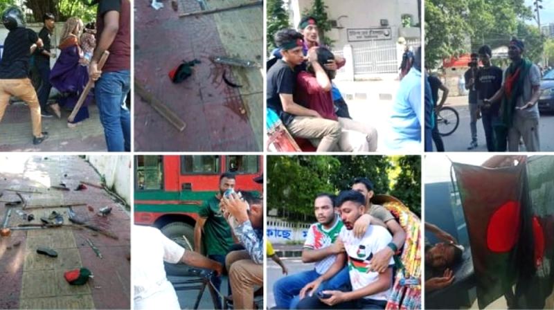 আন্দোলনকারীদের সঙ্গে ছাত্রলীগের দফায় দফায় সংঘর্ষ, আহত ১৫৫